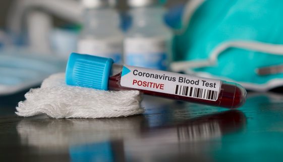 Wisconsin coronavirus